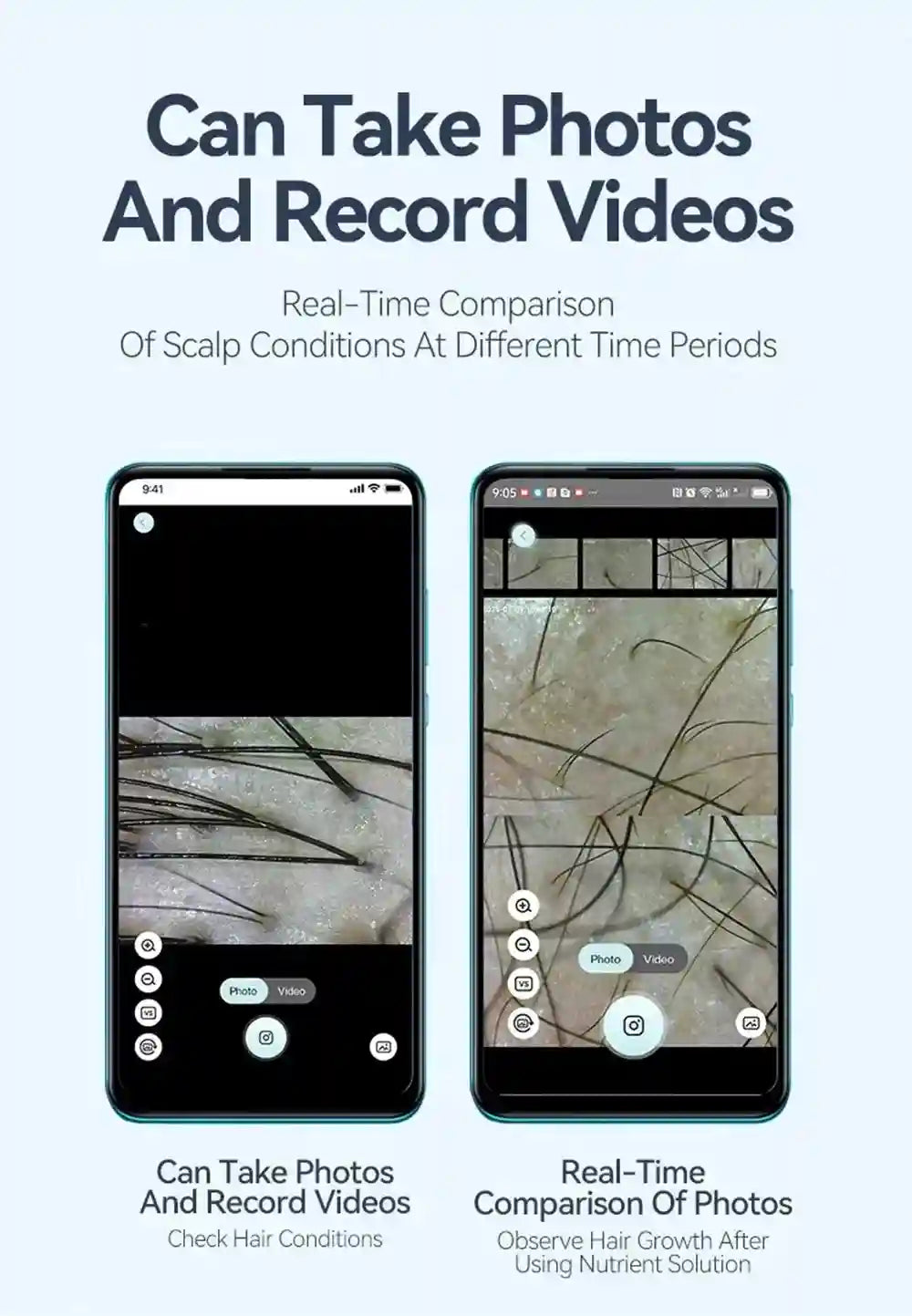 Two smartphones displaying a scalp analysis app for comparing hair and skin conditions via photos and videos.