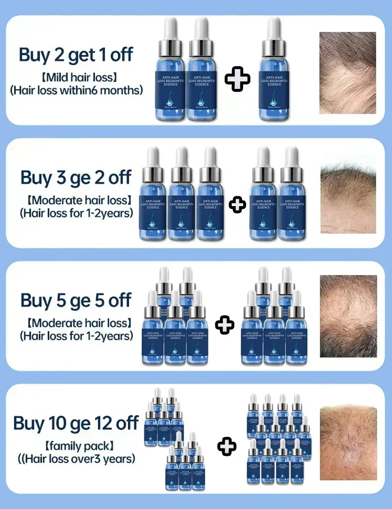 Tidesmit Biotin hair growth oil serum for scalp treatment to prevent hair loss and grow thicker, stronger hair.
