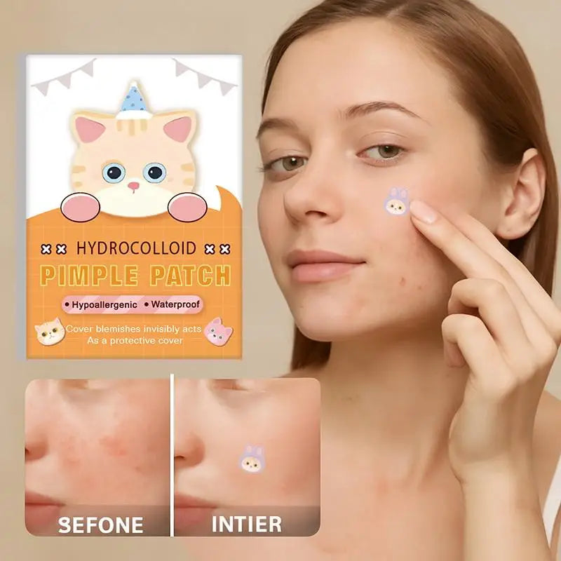 600Pcs Acne Patches Cat Shaped Acne Heal Sticker Colorful Acne Cover Removal Pimple Patch Anti-Acne Hydrocolloid Sticker