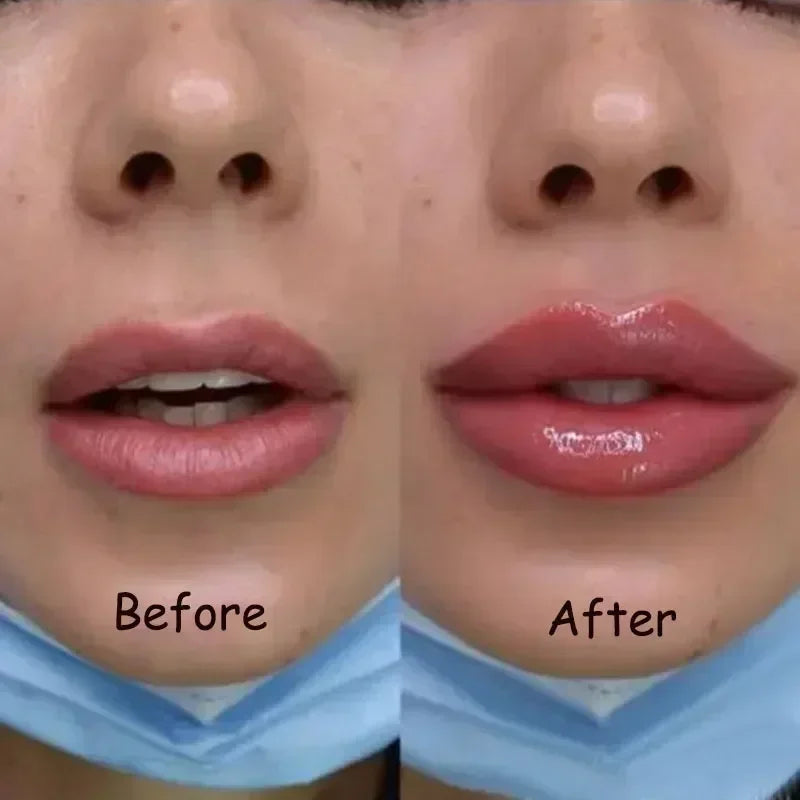 Lip Plumper Oil – Hydrating Serum for Fuller Lips – Cruelty-Free Lip Care Lip Care Tidesmit