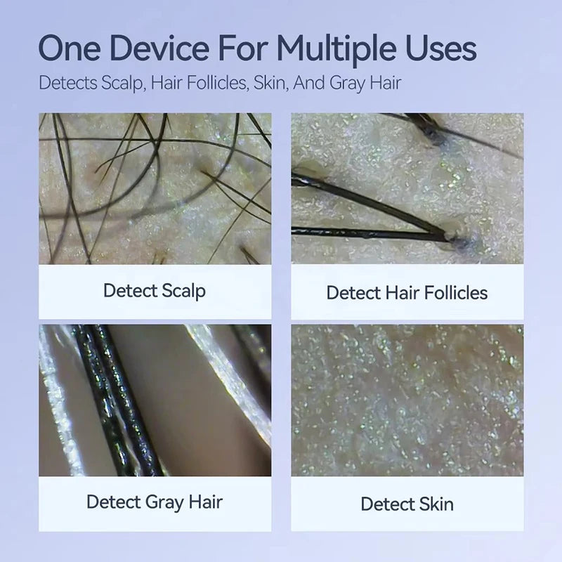 Microscope showing close-up views of scalp, hair follicles, gray hair, and skin for analysis.