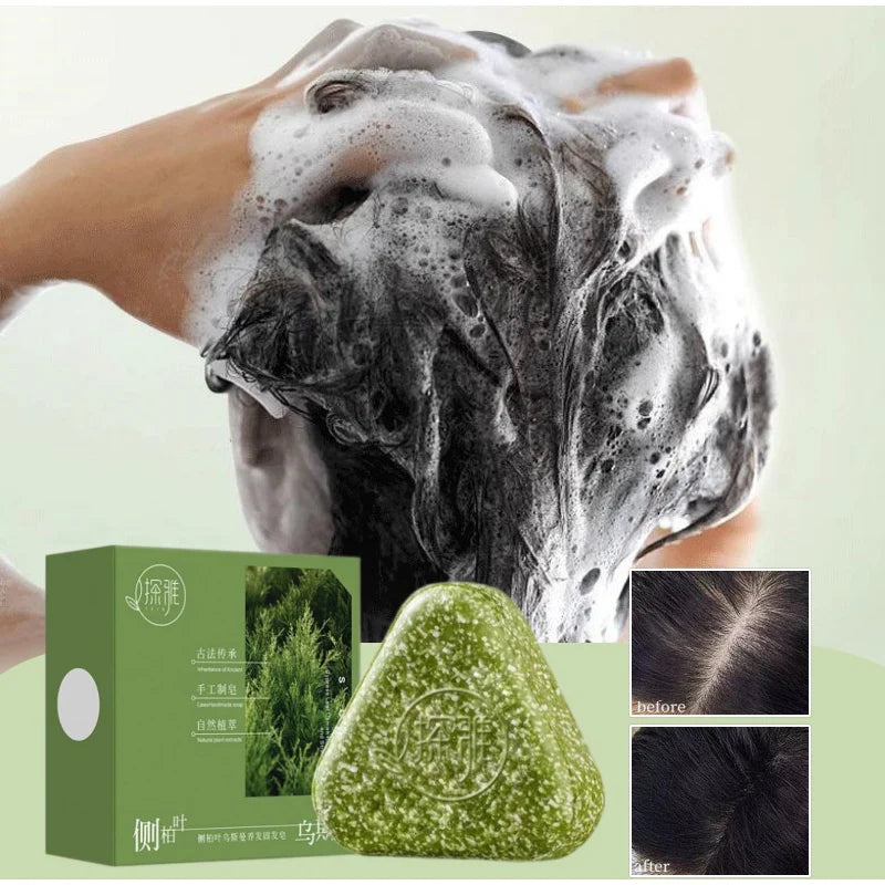 Hair Strengthening Nourishing Shampoo Soap,Oriental Arborvitae Usman Herbal Extract Anti Hair Loss,Face Wash Clean Handmade Soap