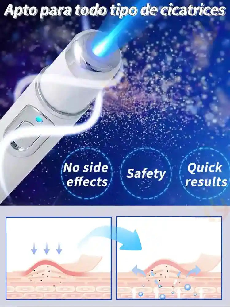 White handheld blue light scar therapy device, with diagrams showing skin treatment on a blue background.