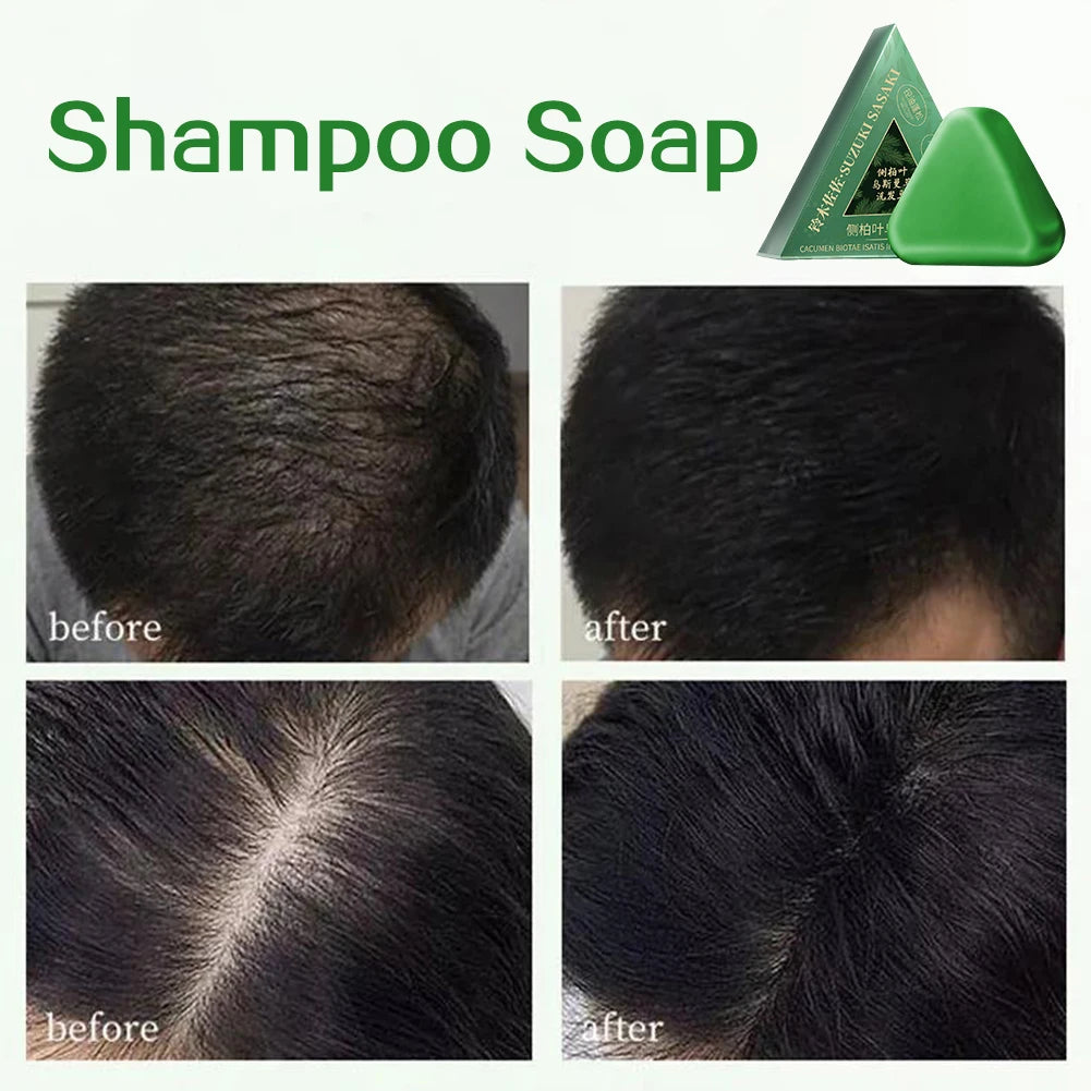 Nature Seven Green Soaps Shampoo Usman Grass Hair Growth Shampoo Bar Thickening Strengthens Hair for Women Men Hair Scalp Care