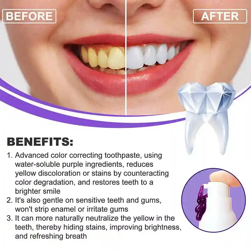 Tidesmit teeth whitening toothpaste gel for effective stain removal and fresh breath, 2025 Korean dental care formula