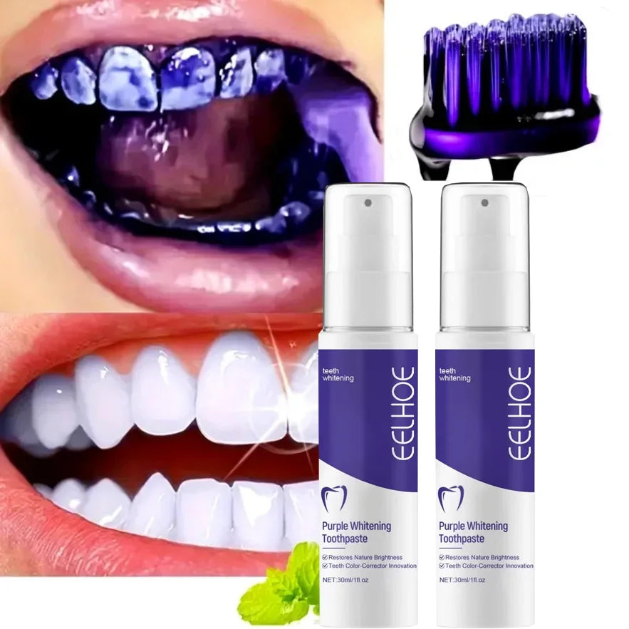 5D Teeth Whitening Toothpaste for Fresh Breath and Oral Care Lip Care Tidesmit