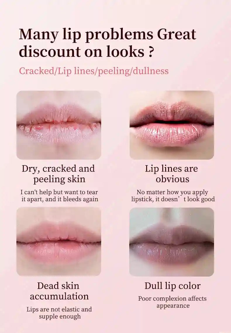 Lip Treatment for Dark Pigmentation - Moisturizing Exfoliator (1-5 Pcs) Lip Care Tidesmit