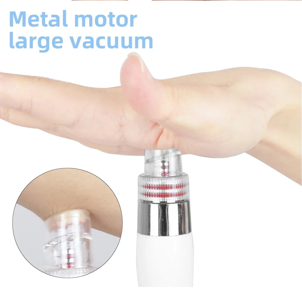White hydro facial machine handle showing strong suction power on skin for deep cleansing and facial lifting.