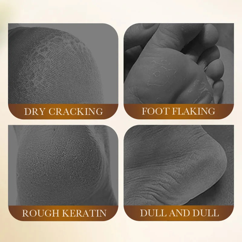 White Rice Foot Mask Moisturizing Exfoliating Treatment - 1-5 Pack Scrubs Treatments Tidesmit