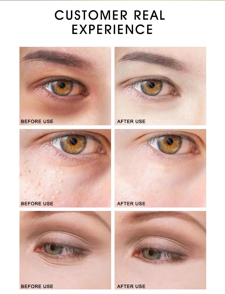 ARTISCARE 24K Gold Serum 3-piece set: before and after results showing reduction of dark circles, milia, and wrinkles.