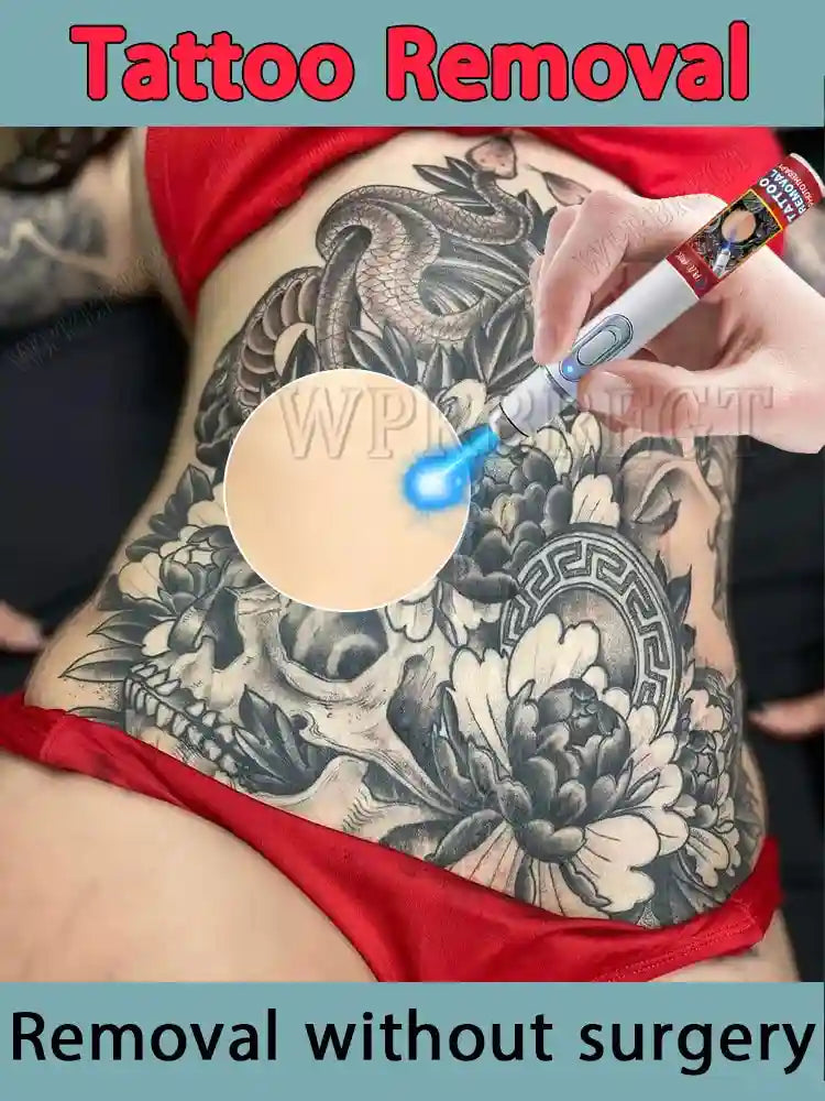 Tattoo Removal Cream - Painless Nano Laser Ink Eraser Treatment Scrubs Treatments Tidesmit