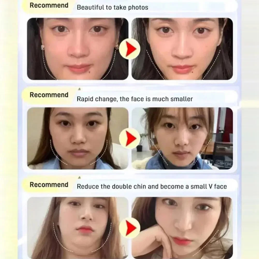 Before and after photos showing facial slimming effects with dotted outlines tracing a narrower jawline.