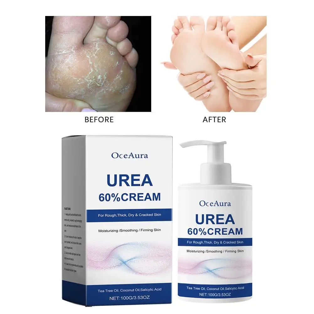 Urea 60% Cream for Cracked Heels - Professional Deep Foot Repair Scrubs Treatments Tidesmit
