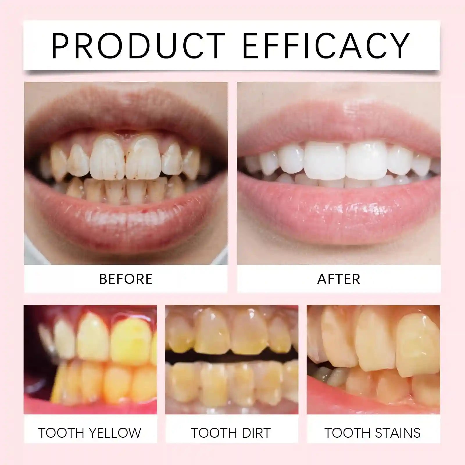 Tidesmit SP-8 Hydroxyapatite teeth whitening toothpaste for deep stain removal and cavity prevention mint flavor