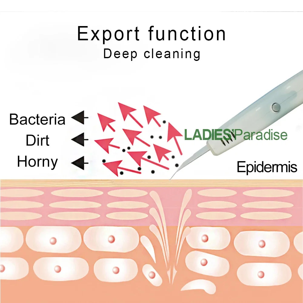 Ultrasonic Facial Skin Scrubber | Deep Pore Exfoliator & Spa Tool Scrubs Treatments Tidesmit