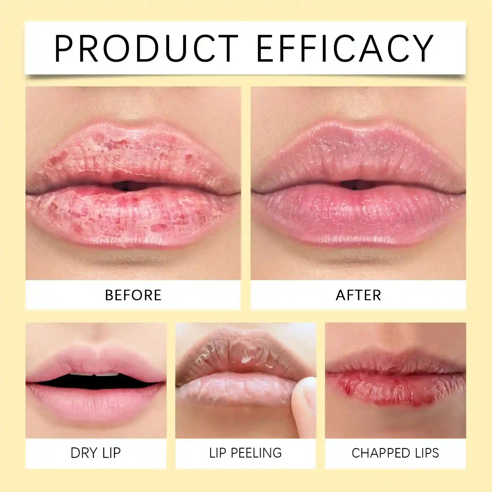 Dark Lip Lightening Balm – Moisturizing Exfoliating Lip Treatment Lip Care Tidesmit