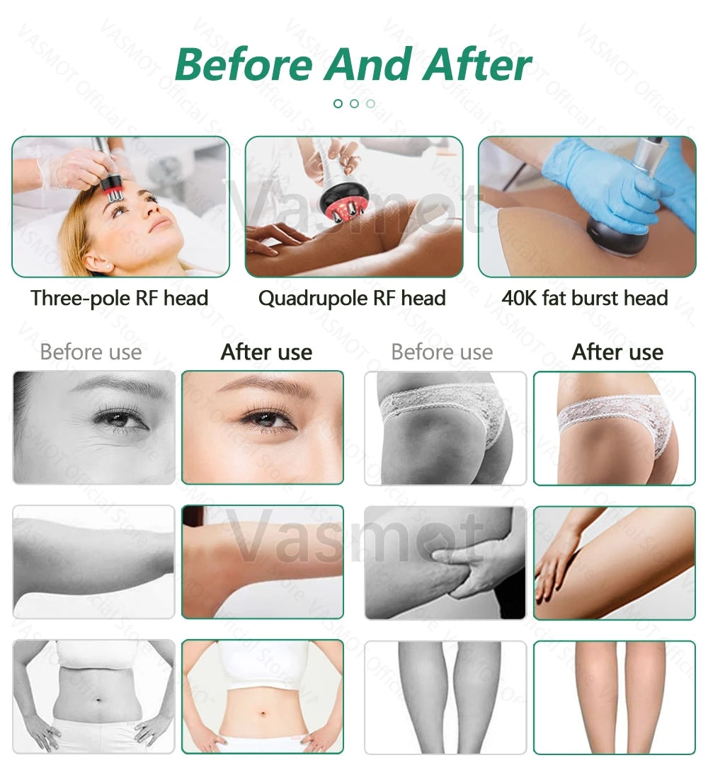 40K Ultrasonic Cavitation Body Sculpting Machine - 6-in-1 Pro Device Relaxation Treatment Tidesmit