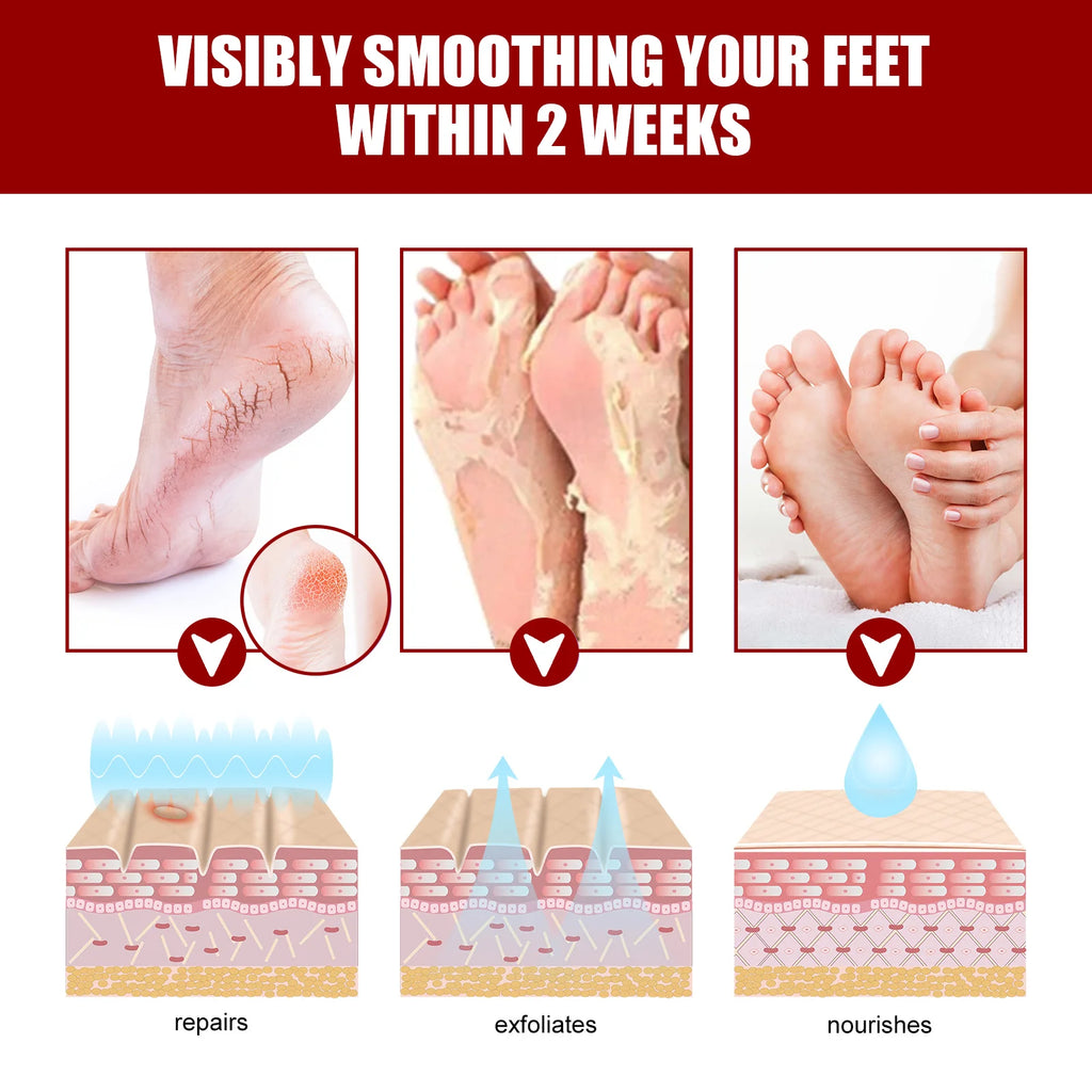 Exfoliating Foot Peel Mask - Apple Extract Callus Remover (5-15 Pack) Scrubs Treatments Tidesmit