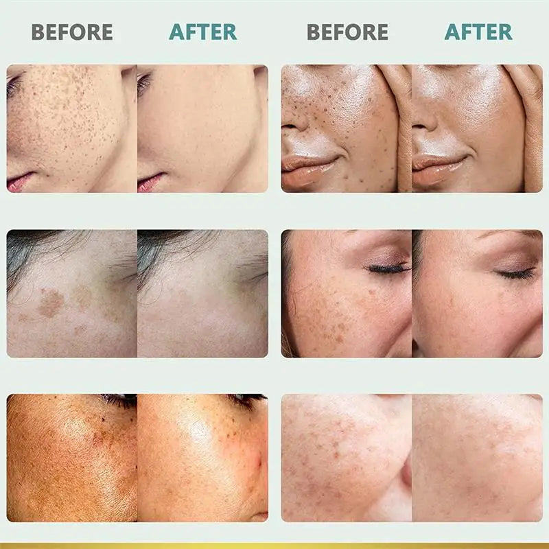 Dark Spot Corrector Cream for Pigmentation & PMU Aftercare | Tidesmit Permanent Makeup Machines Tidesmit
