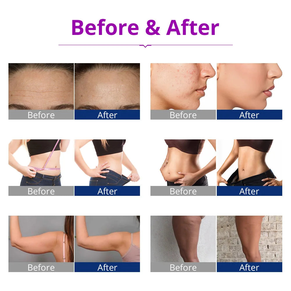 6-in-1 Cavitation Body Slimming & Skin Tightening Device | Tidesmit Body Shaping Massage Equipment Tidesmit