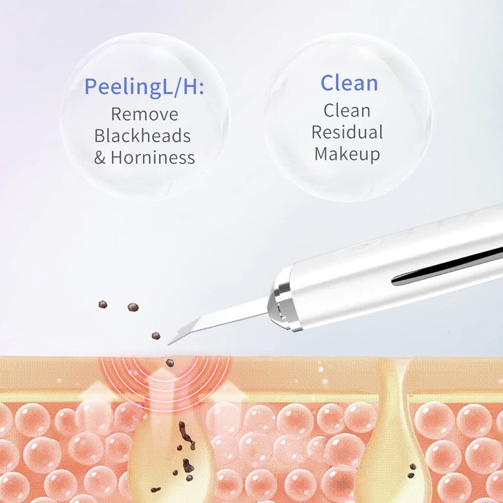 Electric Facial Spatula Skin Scrubber - Deep Pore Cleansing Tool Scrubs Treatments Tidesmit