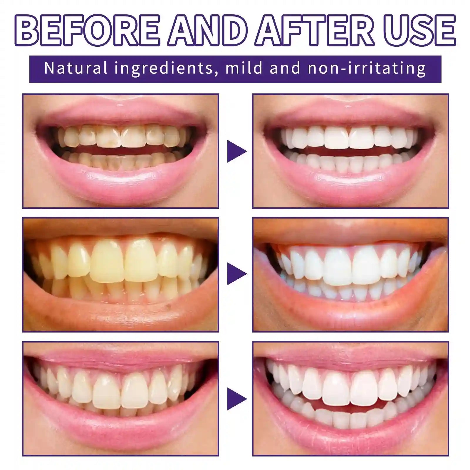 Tidesmit purple mineral tooth powder for enamel-safe teeth whitening, tartar removal, and gum care.