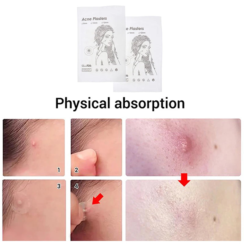 Hot Sale 72Pcs/2Sheets Acne Pimple Patch Clear Gel Invisible Acne Cover Stickers Pimple Remover Beauty Skin Care