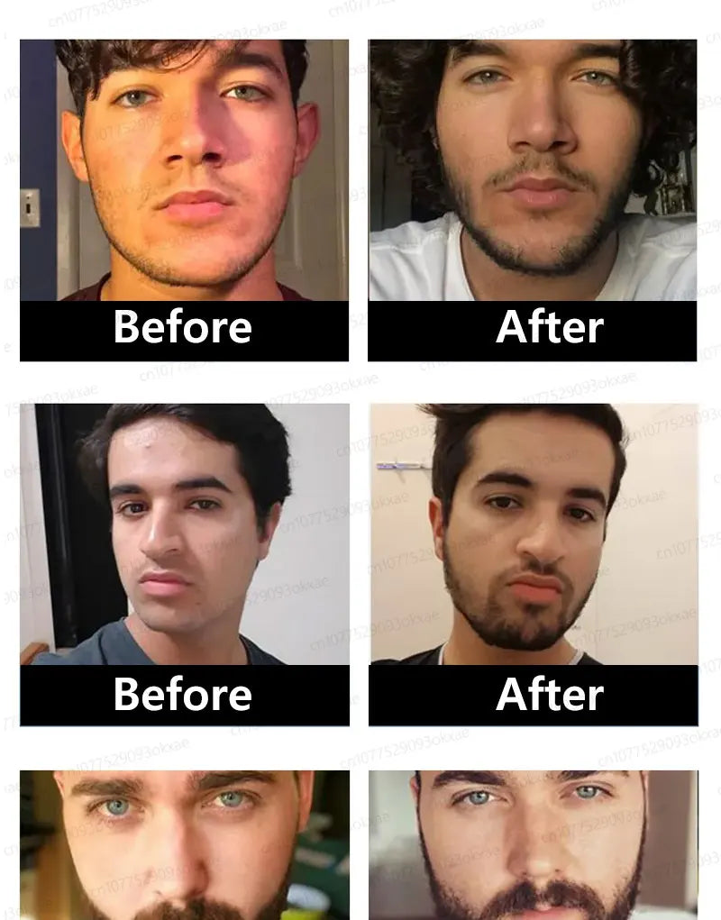 Beard Growth Essence for Thicker Facial Hair - Natural Formula Relaxation Treatment Tidesmit