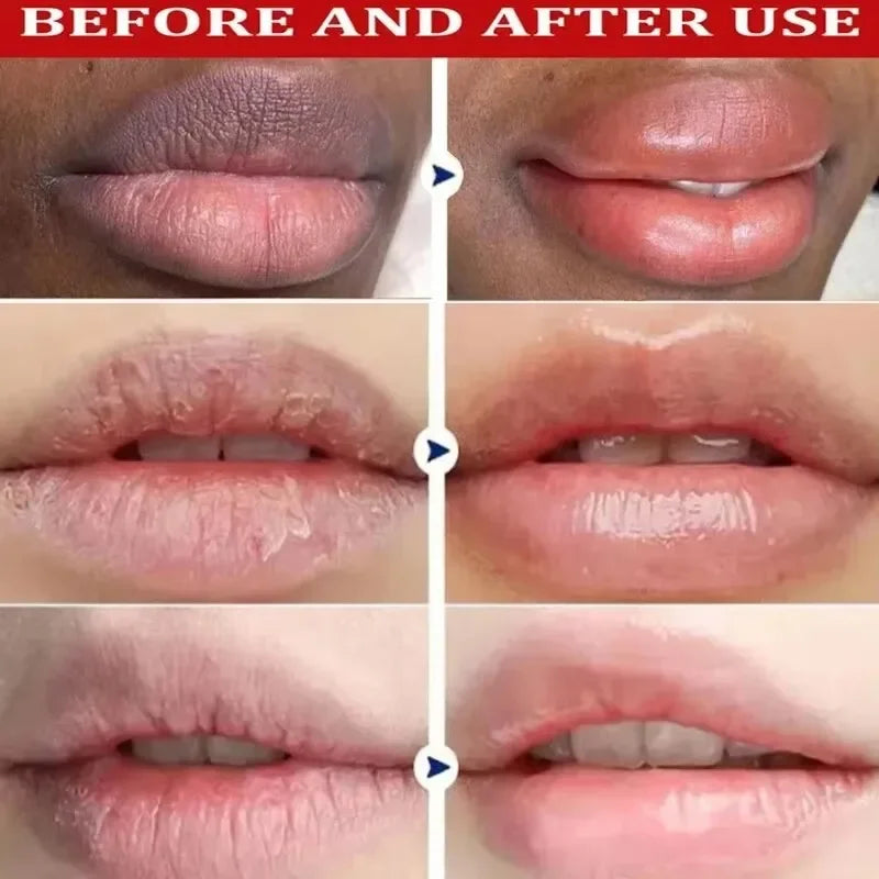Lip Lightening Balm - Exfoliating Treatment for Dark Lips Lip Care Tidesmit