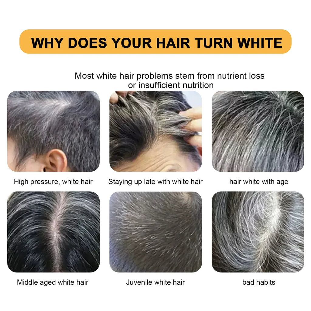 Grey Coverage Bar Shampoo Repair Gray White Hair Color Treatment Smoothing Nourishing Anti Dandruff Natural Hair Darkening Soap
