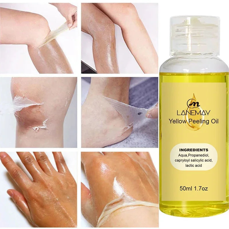 Yellow Peeling Oil for Body Exfoliation - Professional Brightening Serum Scrubs Treatments Tidesmit