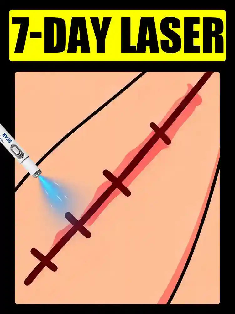 A white laser pen emitting a blue light onto a stitched surgical incision on human skin.