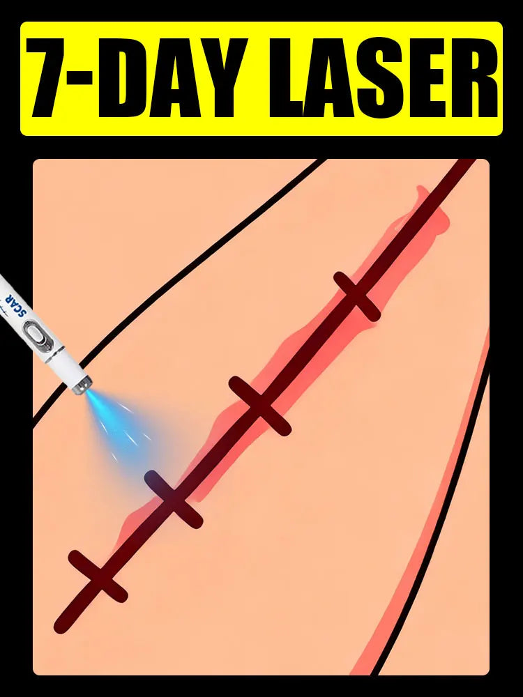 A white laser pen emitting a blue light onto a stitched surgical incision on human skin. Text reads 7-DAY LASER.