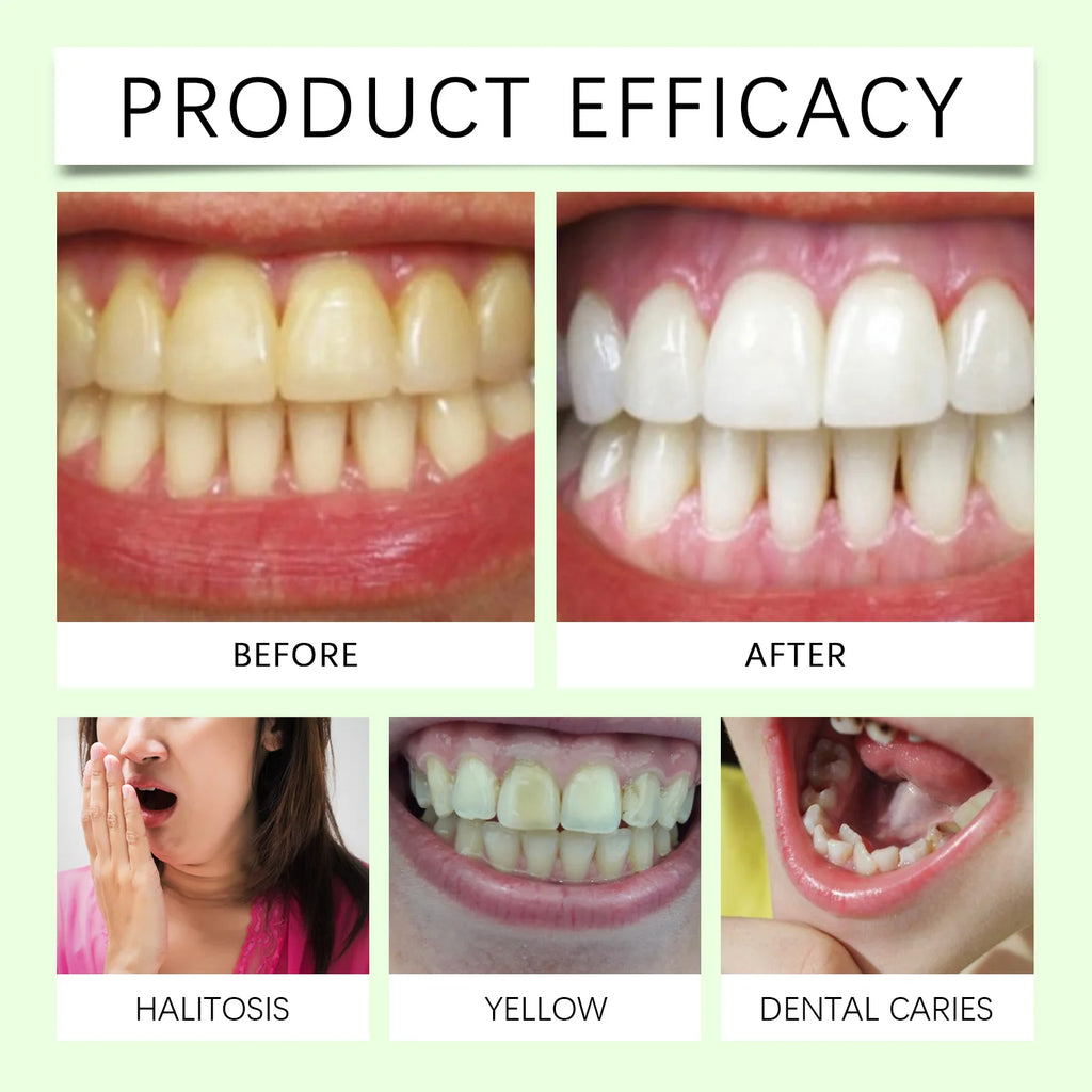 Tidesmit Aloe Vera Mint Teeth Whitening Toothpaste for stain removal and gum comfort