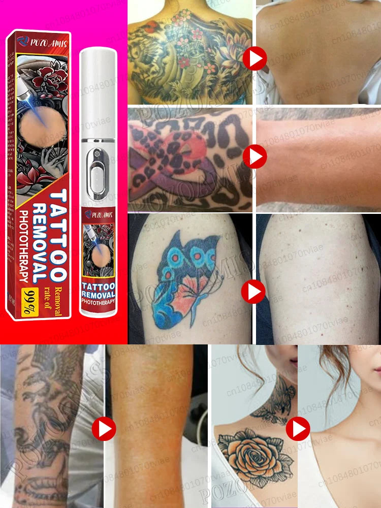 Nano Laser Tattoo Removal Solution | Professional Ink Eraser - Tidesmit Scrubs Treatments Tidesmit