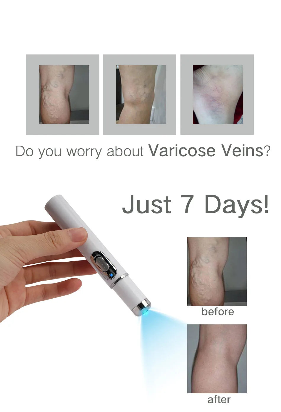 Blue Light Therapy Acne Pen for Skin Repair and Wrinkle Removal Permanent Makeup Machines Tidesmit