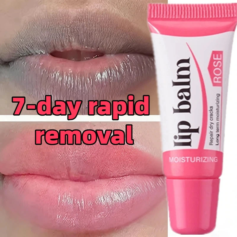 Dark Lip Lightening Balm | Exfoliating Serum for Natural Pink Lips 10g Lip Care Tidesmit