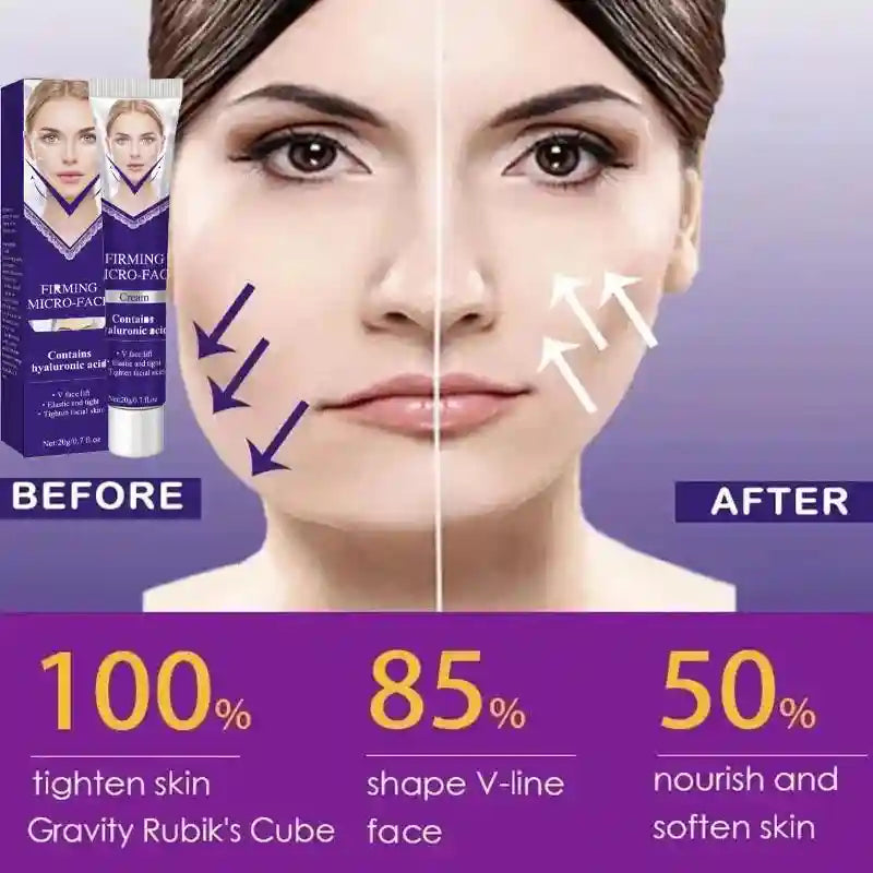 A purple tube of V-Line face lifting cream next to a before-and-after comparison of a woman's face with uplift arrows.