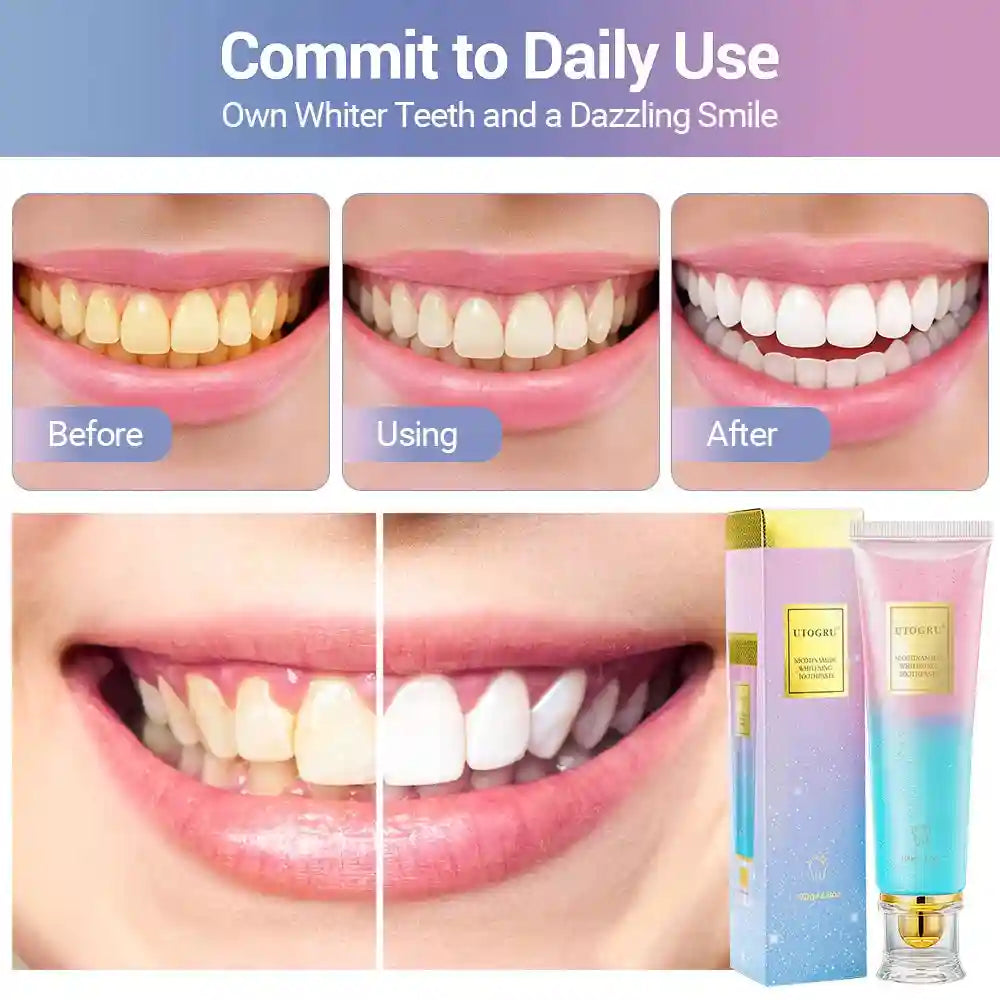 Tidesmit 3-pack teeth whitening toothpaste for sensitive teeth removing coffee and wine stains for fresh breath
