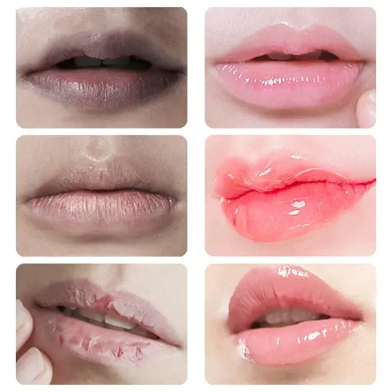 Lip Lightening Mask for Dark Lips - Moisturizing Exfoliator (1-10 Pcs) Lip Care Tidesmit
