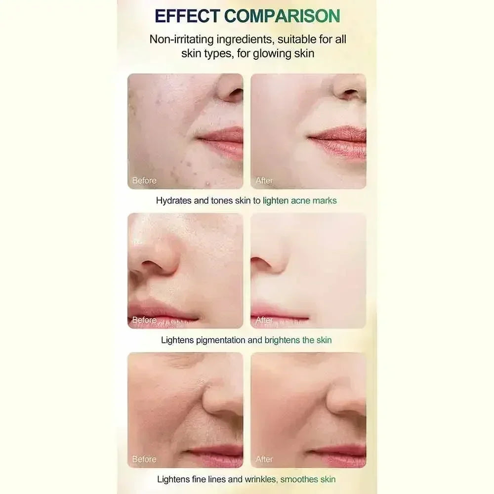 Salicylic Acid Face Peel - Professional Deep Exfoliation & Skin Refinement Scrubs Treatments Tidesmit
