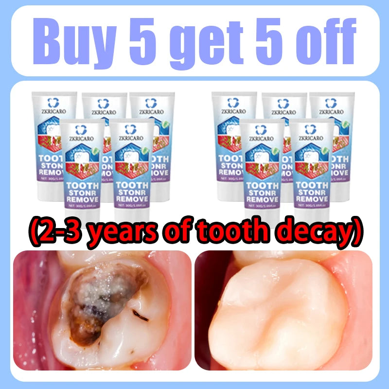 Tooth Decay Repair Treatment | Natural Mineral Enamel Gel | Tidesmit Scrubs Treatments Buy 5 Get 5 Free Tidesmit
