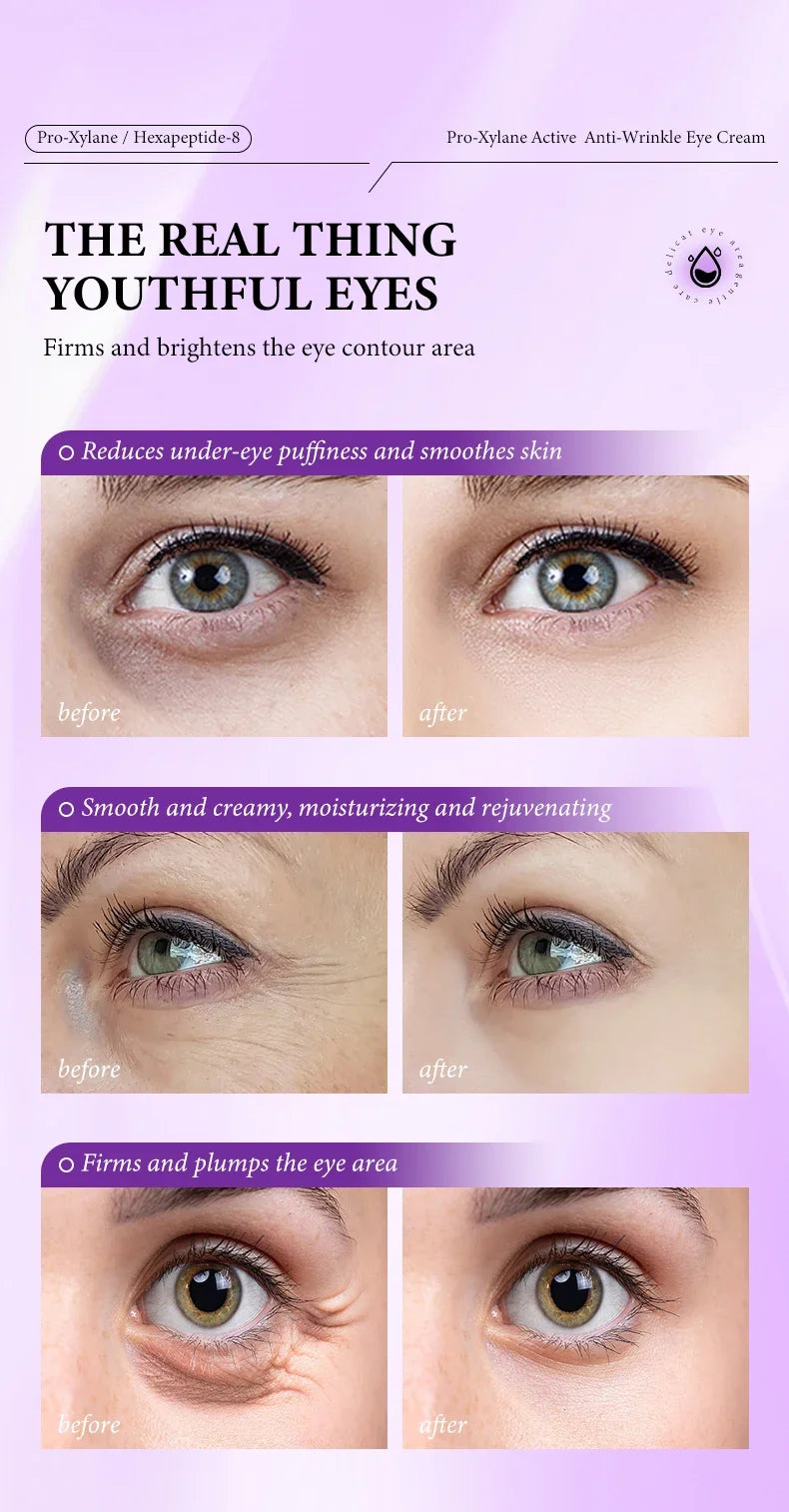 Anti-wrinkle eye cream before and after comparison showing reduced puffiness, dark circles, and fine lines.