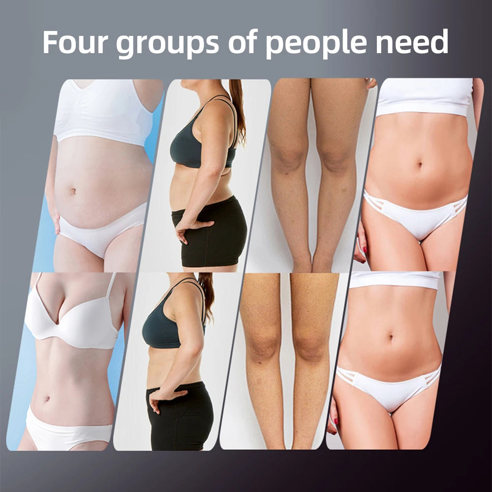 Before and after comparison of body parts targeted by 4-in-1 EMS RF electric body slimming and cellulite massage tool.