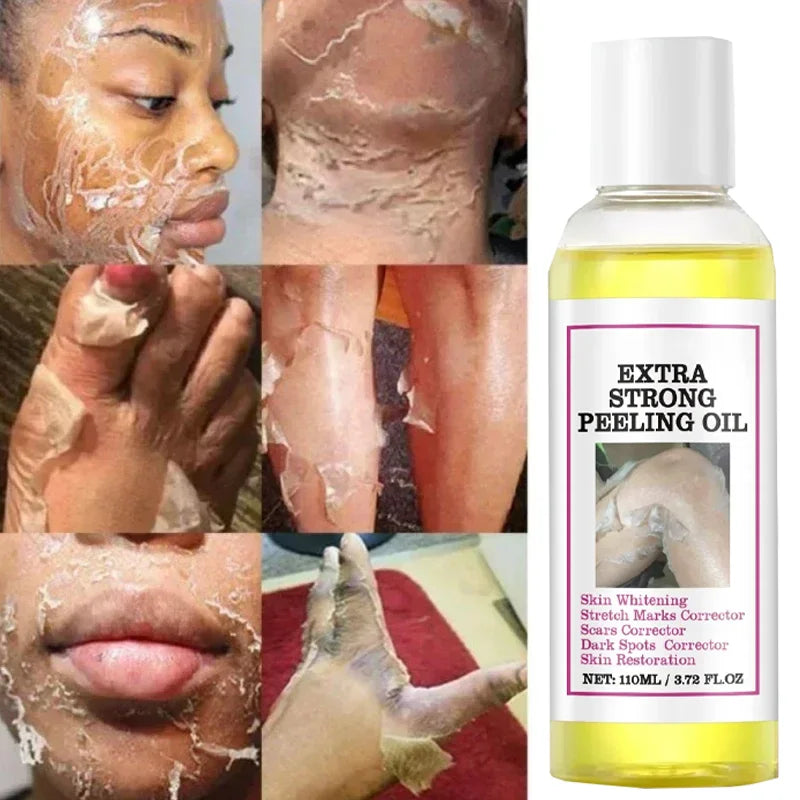 Yellow Peeling Oil for Dark Skin - Salon-Quality 100ml Exfoliating Treatment Scrubs Treatments Tidesmit