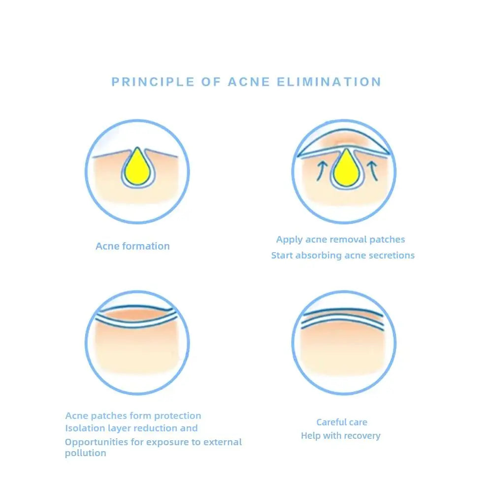 Blue/Yellow Stars Hydrocolloid Pimple Patches with Mirror Storage Box,Acne Spot Stickers For Face,Temporary Mirror Makeup Tool