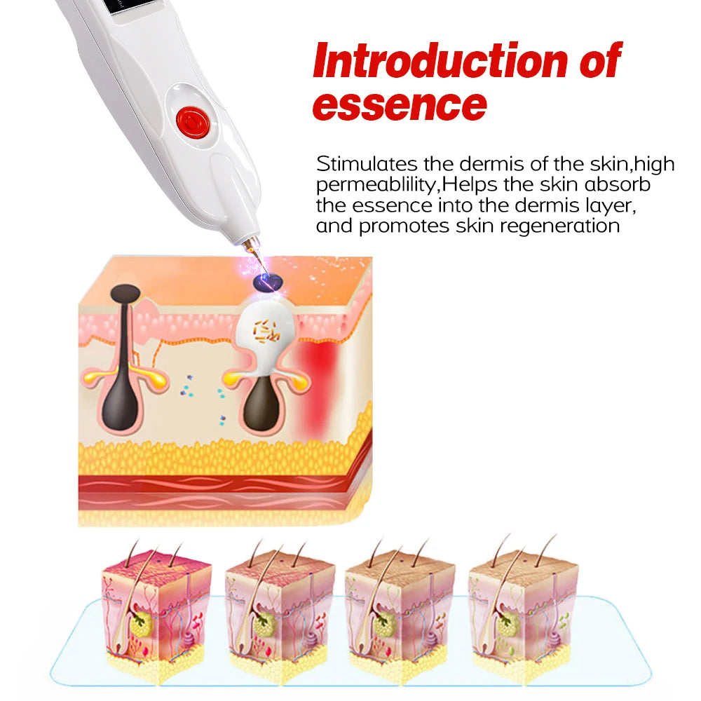 White plasma pen for mole, freckle, and dark spot removal with skin absorption diagram for home skincare treatments.