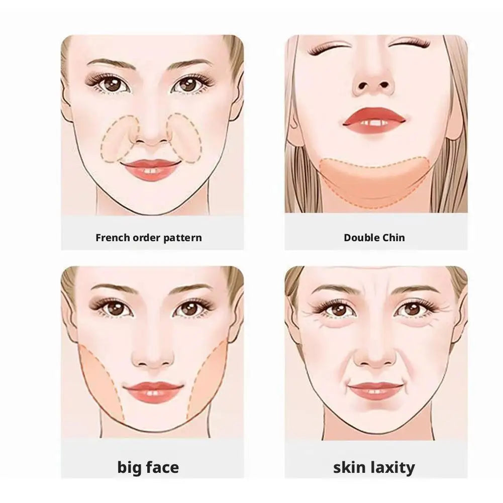 Four illustrated facial zones highlighting common concerns: smile lines, double chin, wide jaw, and skin laxity.