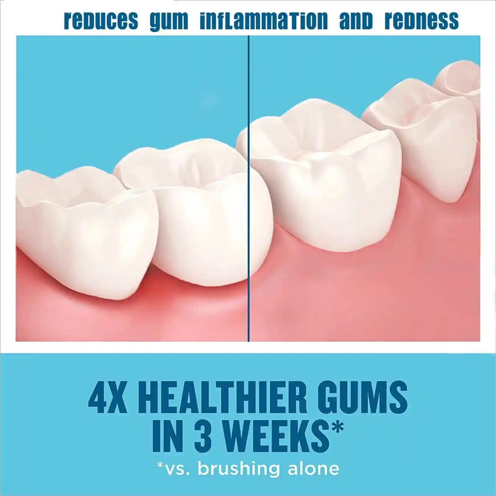 Tidesmit teeth whitening mousse for deep dental stain removal and professional gum care