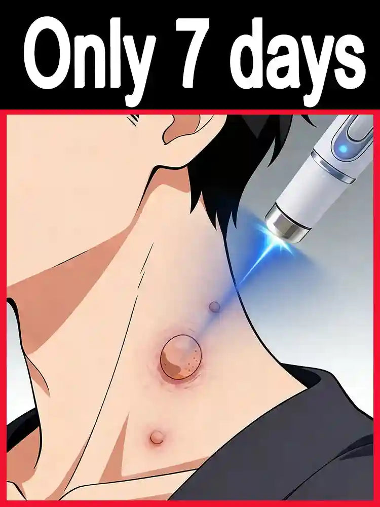 Wart Removal Pen | Painless Skin Tag Laser Device | Tidesmit (1pc/2pc) Relaxation Treatment Tidesmit